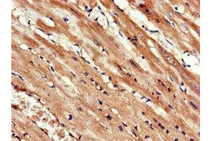 Immunohistochemistry of paraffin-embedded human heart tissue using ABIN7157595 at dilution of 1:100 (KIF14 Antikörper  (AA 261-531))