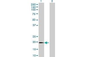 Western Blot analysis of C1orf84 expression in transfected 293T cell line by C1orf84 MaxPab polyclonal antibody. (Chromosome 1 Open Reading Frame 84 (C1orf84) (AA 1-178) Antikörper)