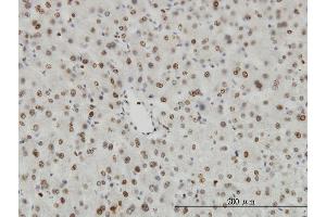 Immunoperoxidase of monoclonal antibody to HDAC1 on formalin-fixed paraffin-embedded human liver. (HDAC1 Antikörper  (AA 1-482))