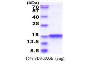 SDS-PAGE (SDS) image for Inner Mitochondrial Membrane Peptidase Subunit 2 (IMMP2L) (AA 38-175) protein (His tag) (ABIN5853862) (IMMP2L Protein (AA 38-175) (His tag))