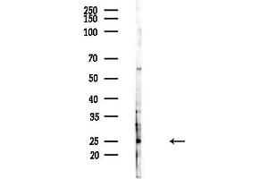 Western blot analysis of lysates from Hela cells(heat-shock,45 min treatment), using APOBEC3A/B Antibody at 1/1000 dilution. (APOBEC3A/B Antikörper)
