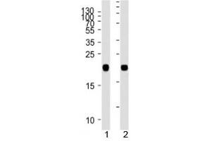 NRAS antibody western blot analysis in 1) human A431 and 2) rat C6 lysate. (GTPase NRas Antikörper  (AA 70-101))