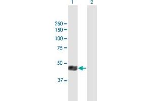 anti-Solute Carrier Family 16, Member 1 (Monocarboxylic Acid Transporter 1) (SLC16A1) (AA 1-500) antibody