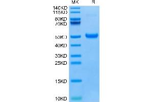 SDS-PAGE (SDS) image for Dickkopf Homolog 1 (DKK1) (AA 178-266), (C-Term) protein (Fc-Avi Tag) (ABIN7274474)
