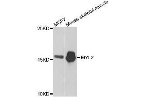 Western blot analysis of extracts of various cell lines, using MYL2 antibody. (MYL2 Antikörper  (AA 1-166))