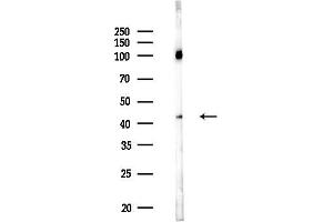 anti-Pleckstrin Homology-Like Domain, Family A, Member 1 (PHLDA1) (N-Term) antibody