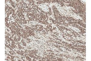 Immunohistochemistry analysis using Rabbit Anti-SFRP2 Polyclonal Antibody (ABIN5696085). (SFRP2 Antikörper  (AA 195-295) (Atto 390))