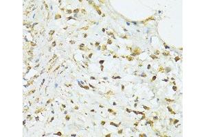 Immunohistochemistry of paraffin-embedded Human vermiform appendix using TRIM15 Polyclonal Antibody at dilution of 1:100 (40x lens). (TRIM15 Antikörper)