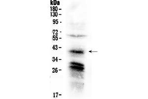 Western blot analysis of CXCR4 using anti-CXCR4 antibody . (CXCR4 Antikörper  (C-Term))