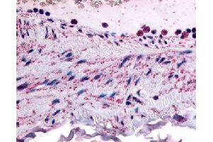 Immunohistochemical (Formalin/PFA-fixed paraffin-embedded sections) staining in human vascular smooth muscle with PTPMT1 polyclonal antibody . (PTPMT1 Antikörper)