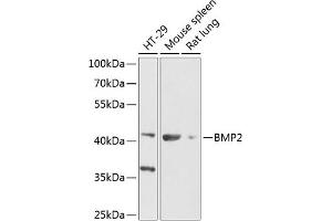 Western blot analysis of extracts of various cell lines, using BMP2 Antibody (ABIN6127494, ABIN6137595, ABIN6137596 and ABIN6216531) at 1:1000 dilution. (BMP2 Antikörper  (AA 1-100))