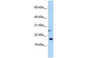 Image no. 1 for anti-Nudix (Nucleoside Diphosphate Linked Moiety X)-Type Motif 15 (NUDT15) (AA 33-82) antibody (ABIN6748042) (NUDT15 Antikörper  (AA 33-82))
