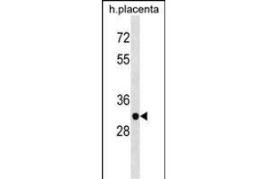 ZN Antibody (N-term) (ABIN1538903 and ABIN2838229) western blot analysis in human placenta tissue lysates (35 μg/lane). (ZNF783 Antikörper  (N-Term))