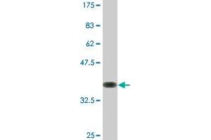 Western Blot detection against Immunogen (36. (LIM Domain Kinase 1 Antikörper  (AA 548-647))