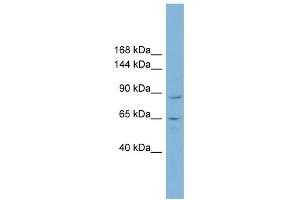 MGC16169 antibody used at 1 ug/ml to detect target protein. (TBCK Antikörper  (Middle Region))