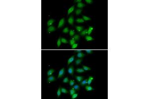 Immunofluorescence analysis of HeLa cells using PPP2CA antibody (ABIN5974047).