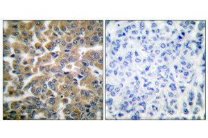 Immunohistochemistry (IHC) image for anti-GR (Internal Region), (pSer211) antibody (ABIN1847912) (GR (Internal Region), (pSer211) Antikörper)