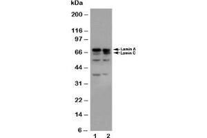 Western blot testing of Lamin A/C antibody and Lane 1:  HeLa;  2: A431 cell lysate (Lamin A/C Antikörper  (AA 455-469))