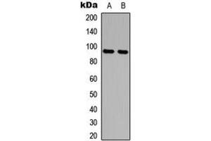 Western blot analysis of AMPD2 expression in MCF7 (A), HeLa (B) whole cell lysates.