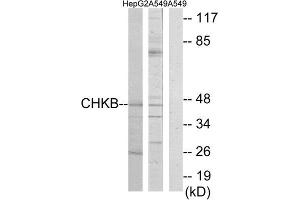 Western Blotting (WB) image for anti-Choline Kinase beta (CHKB) (C-Term) antibody (ABIN1850103) (CHKB Antikörper  (C-Term))