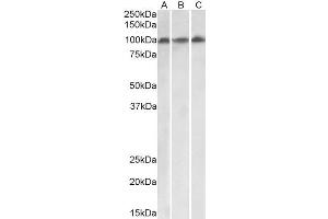 ABIN4902793 (0. (VPS16 Antikörper  (Isoform 1))