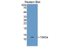 Detection of Recombinant DEFb1, Rat using Polyclonal Antibody to Defensin Beta 1 (DEFb1) (beta Defensin 1 Antikörper  (AA 22-69))