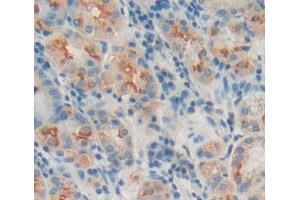 Used in DAB staining on fromalin fixed paraffin- embedded stomach tissue (MPP3 Antikörper  (AA 385-570))