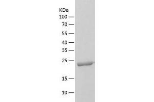 Western Blotting (WB) image for ClpP Caseinolytic Peptidase, ATP-Dependent, Proteolytic Subunit Homolog (E. Coli) (CLPP) (AA 57-277) protein (His tag) (ABIN7122410) (CLPP Protein (AA 57-277) (His tag))