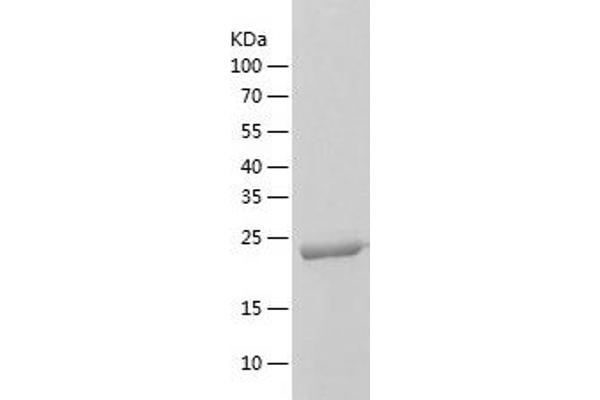 CLPP Protein (AA 57-277) (His tag)