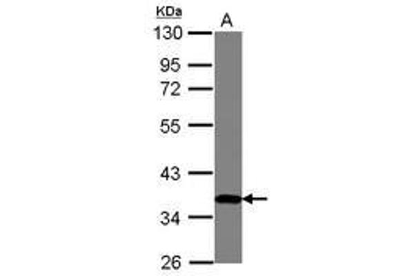 ZNF177 Antikörper  (AA 113-301)