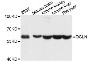 Western blot analysis of extracts of various cells, using OCLN antibody. (Occludin Antikörper)