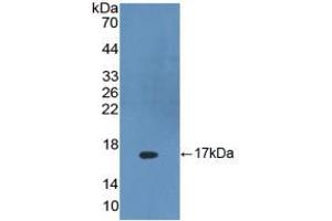 Figure. (DKK4 Antikörper  (AA 107-212))