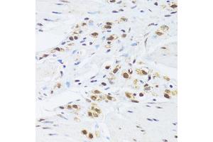 Immunohistochemistry of paraffin-embedded human stomach using GABPB1 Antibody (ABIN2562720) at dilution of 1:100 (40x lens). (GABPB1 Antikörper)