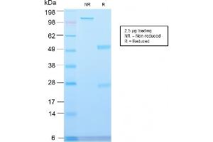 SDS-PAGE Analysis Major Vault Protein Rabbit Recombinant Monoclonal Antibody (VP2897R).