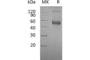 Western Blotting (WB) image for Activin A Receptor Type II-Like 1 (ACVRL1) protein (Fc Tag) (ABIN7320736) (ACVRL1 Protein (Fc Tag))