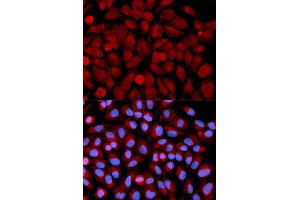 Immunofluorescence analysis of U2OS cell using MAPK9 antibody. (JNK2 Antikörper  (AA 1-424))