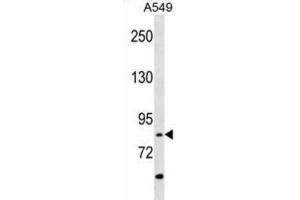 Western Blotting (WB) image for anti-Receptor-Interacting Serine-threonine Kinase 4 (RIPK4) antibody (ABIN3003506) (RIPK4 Antikörper)