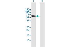 Western Blot analysis of UGT1A9 expression in transfected 293T cell line by UGT1A9 MaxPab polyclonal antibody. (UGT1A9 Antikörper  (AA 1-530))