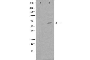 Western blot analysis of Hela cell lysate, using TRAF7 Antibody.