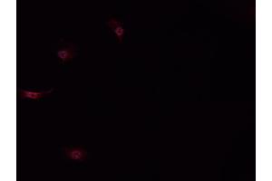 ABIN6268914 staining MCF-7 cells by IF/ICC. (RAN Antikörper  (C-Term))