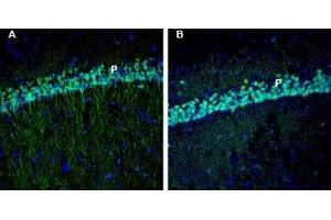 Expression of EphA3 in rat and mouse hippocampus - Immunohistochemical staining of perfusion-fixed frozen rat and mouse brain sections with Anti-EphA3 (extracellular) Antibody (ABIN7043123, ABIN7044245 and ABIN7044246), (1:200), followed by goat anti-rabbit-AlexaFluor-488. (EPH Receptor A3 Antikörper  (Extracellular, N-Term))