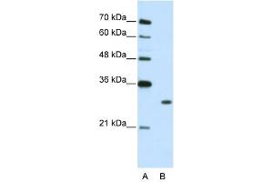 WB Suggested Anti-MBNL1  Antibody Titration: 2. (MBNL1 Antikörper  (C-Term))