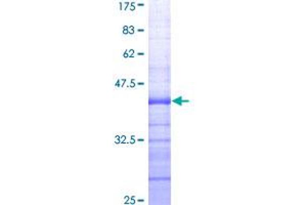 EZH2 Protein (AA 1-110) (GST tag)