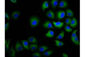 Immunofluorescence staining of A549 cells with ABIN7146688 at 1:100, counter-stained with DAPI. (CHST3 Antikörper  (AA 316-427))