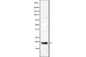 Western blot analysis of HES3 expression in HEK293 cells ,The lane on the left is treated with the antigen-specific peptide. (HES3 Antikörper  (N-Term))