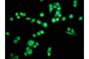 Immunofluorescence staining of PC-3 cells with ABIN7164696 at 1:66, counter-stained with DAPI. (PDCD6 Antikörper  (AA 1-191))