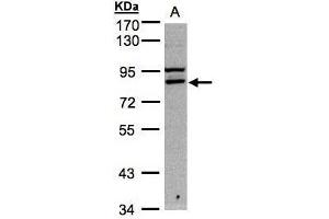 WB Image Sample A: 30μg of Hep G2 whole cell lysate , 7. (FASTKD1 Antikörper)
