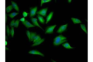 Immunofluorescence staining of Hela Cells with ABIN7127669 at 1:50, counter-stained with DAPI. (Rekombinanter PCYT1A Antikörper)
