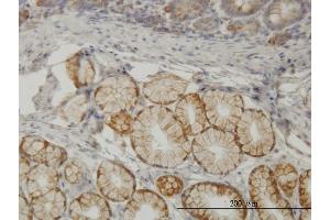Immunoperoxidase of monoclonal antibody to TLN1 on formalin-fixed paraffin-embedded human small Intestine. (TLN1 Antikörper  (AA 1052-1149))
