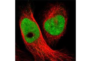 Immunofluorescent staining of human cell line U-2 OS shows positivity in nuclei but not nucleoli.